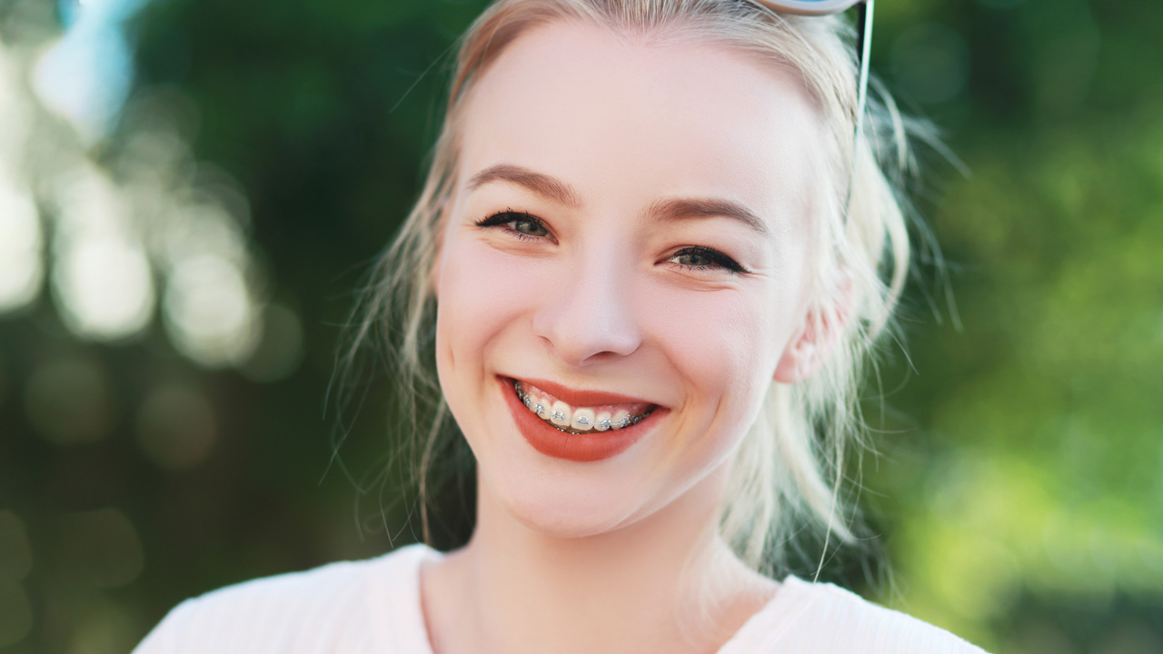 O tempo médio com aparelho fixo convencional é 2 anos