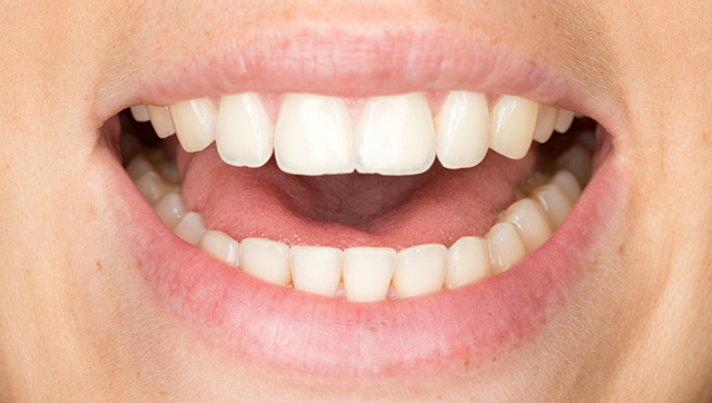 Definição do cancro oral