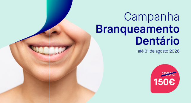campanha de branqueamento dentário 